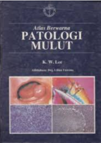 Image of Atlas Berwarna Patologi Mulut