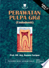 Image of Perawatan Pulpa Gigi: endodonti