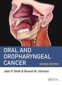 Image of Oral and Oropharyngeal Cancer